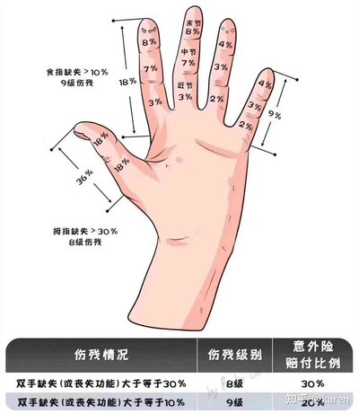 工傷賠償金額如何算？香港法律專家教你爭取權益