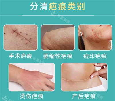工傷美容手術費可報銷？香港索償全攻略